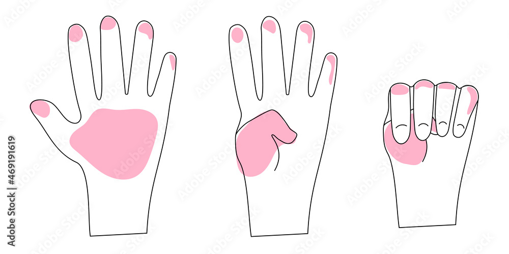 The Signal for Help, singlehanded gesture. Violence at Home Signal for