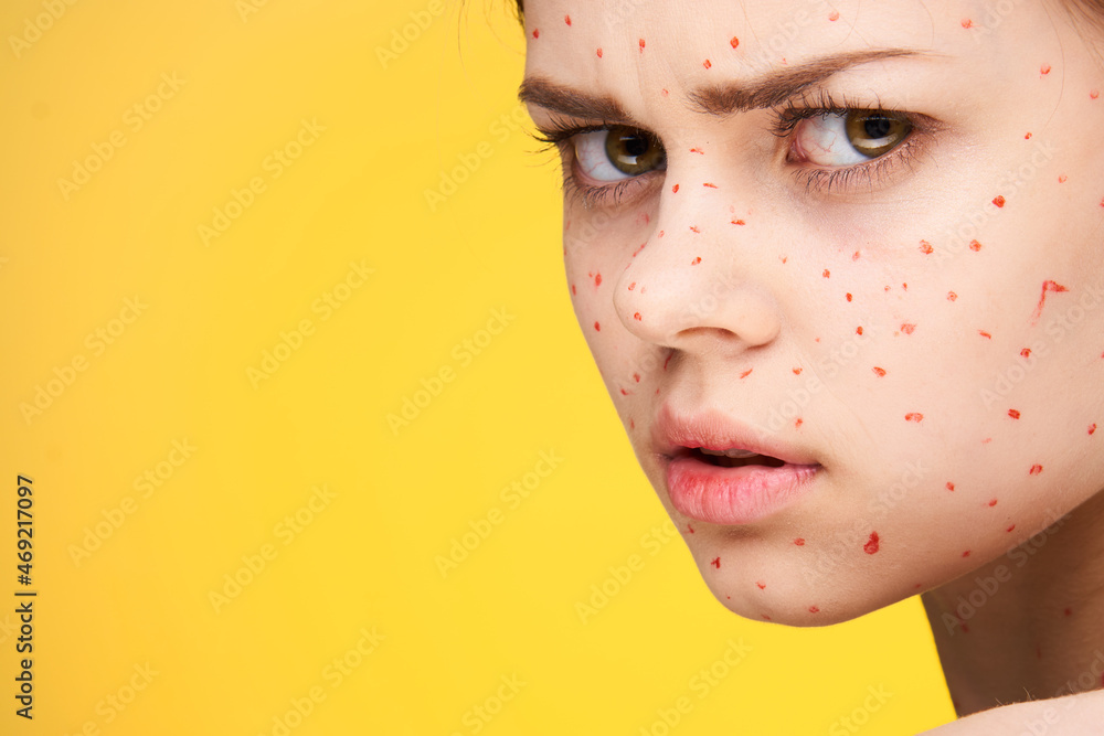 woman-with-red-dots-on-her-face-skin-problems-dermatology