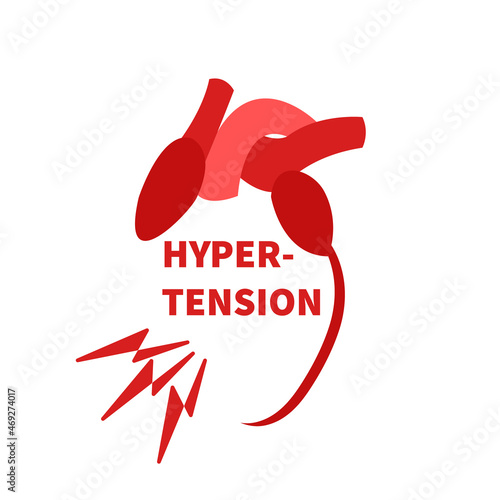 World hypertension awareness day. Heart disease prevention. High blood pressure treatment. Medical concept. Flat vector illustration.