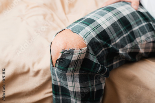 Torn pants, hole in place of knee, problem with clothes. Close-up of man showing spoiled home clothes, indoors