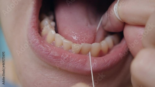 Dental floss. Chitska teeth with dental floss close-up, observance of oral hygiene