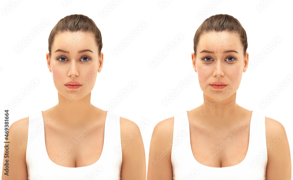 Effects of ageing,Frown/scowl lines ,Nasolabial folds,Neck ,Under eye circles,neck lines