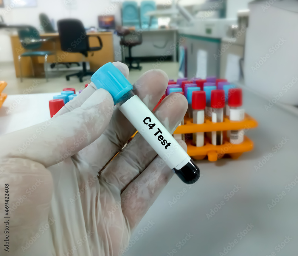 Blood Sample for C4 (Complement) Test with laboratory background. Closeup. Diagnosis of autoimmune disorders Blood Sample for C4 (Complement) Test with laboratory background. Closeup. Diagnosis of autoimmune disorders