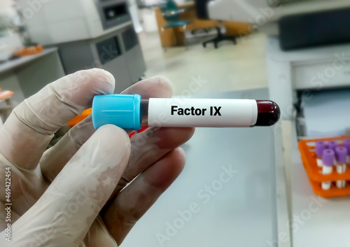 Blood Sample for Factor IX. Blood coagulation testing. Medical or health concept. Antihemophilic Factor B, Christmas disease, factor IX hemophilia photo