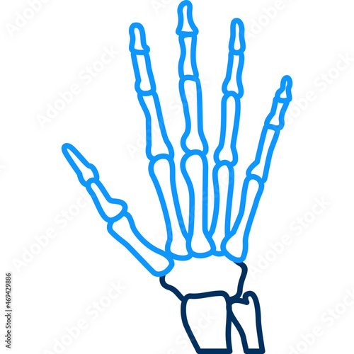 Hand Fracture