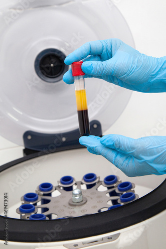 Blood test in a centrifuge. Plasma tube.