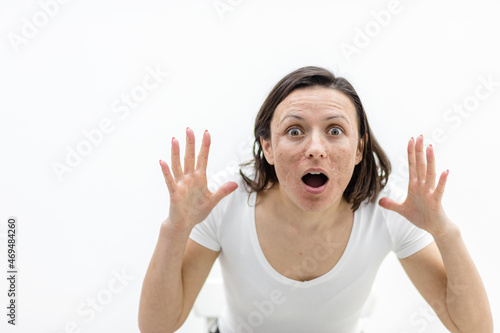 Photo of shocked woman because of her skin problems.
