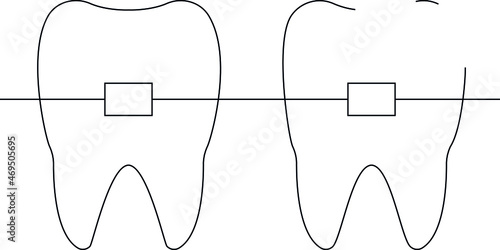 dental icons braces and mouth