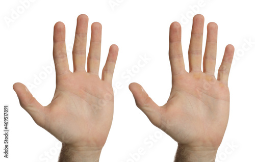 Man showing hands without and with calluses on white background., closeup. Collage © New Africa