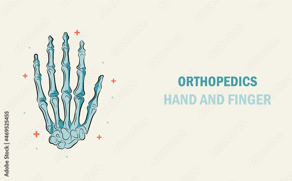 Orthopedics treatment of bone hand and finger injury. Abstract traumatology and orthopedics. Medical science in the hospital for body joints. Orthopedics treatment of bone hand and finger injury. Abstract traumatology and orthopedics. Medical science in the hospital for body joints.