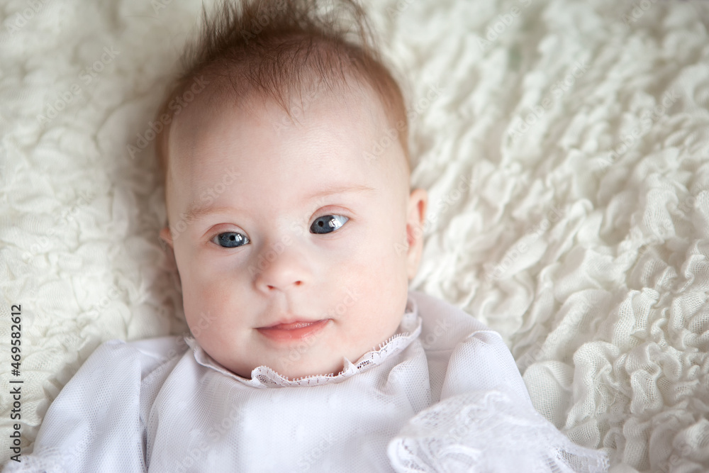Portrait of a positive girl with Down syndrome. Portrait of a positive girl with Down syndrome.
