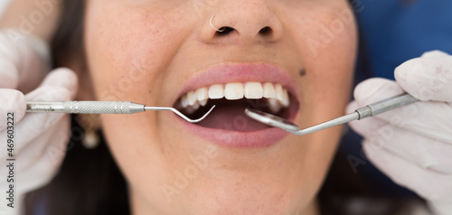Close up hands of dentist in the gloves holding dental probe and intraoral mirror near woman teeth