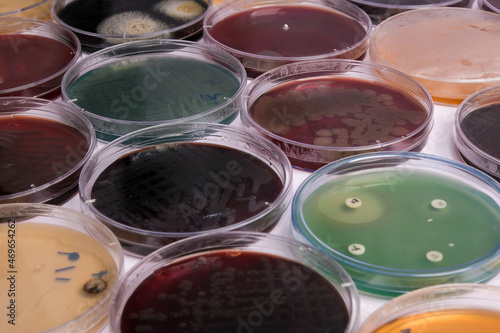 collection of culture plates contain growth of microorganisms on different agar media photo