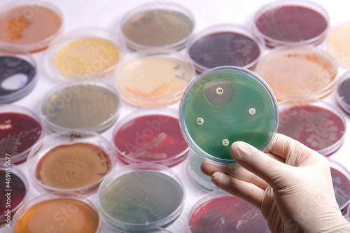collection of culture plates contain growth of microorganisms on different agar media photo