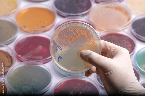 collection of culture plates contain growth of microorganisms on different agar media photo