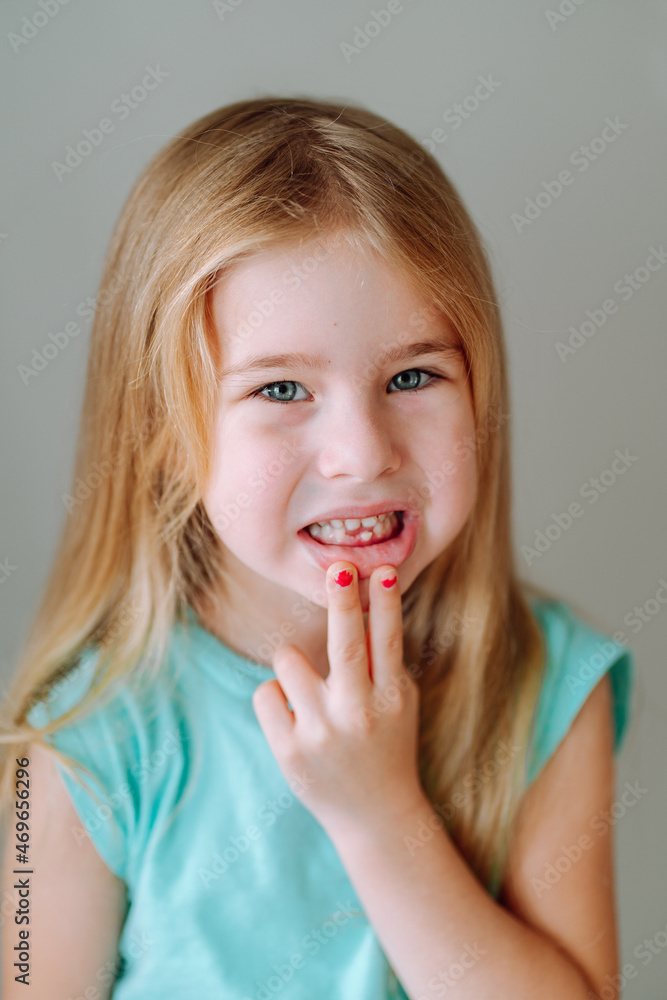 Portrait of preschool girl smiling and showing her mouth with a fallen milk tooth. Dental hygiene, tooth fairy Portrait of preschool girl smiling and showing her mouth with a fallen milk tooth. Dental hygiene, tooth fairy