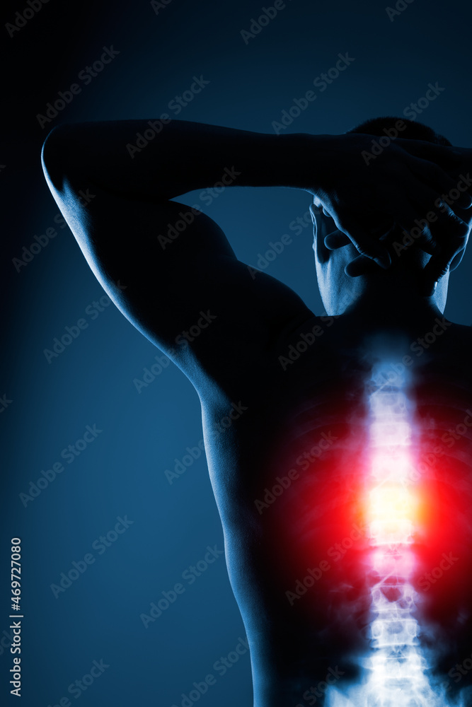 Naklejka premium Human spine in x-ray on blue background. The thoracic spine is highlighted by yellow red colour.