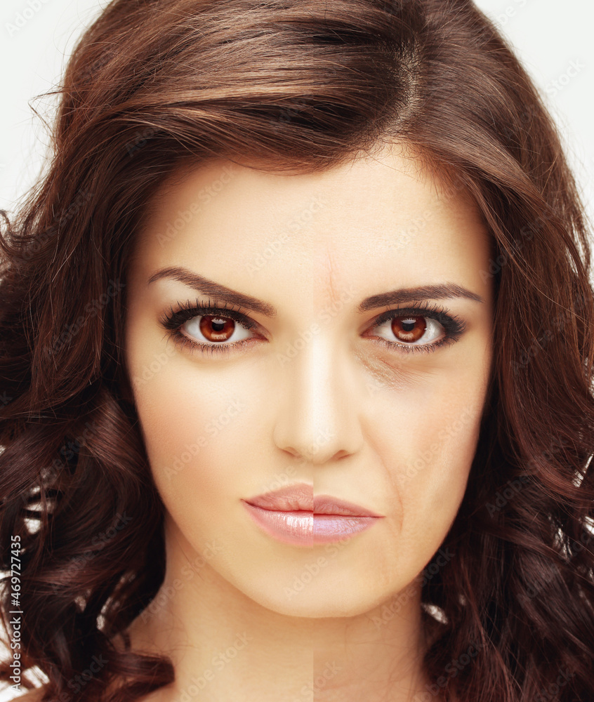 Effects of ageing,Frown lines ,Nasolabial folds,Neck ,Under eye circles,neck lines. Plastic Surgery Results Effects of ageing,Frown lines ,Nasolabial folds,Neck ,Under eye circles,neck lines. Plastic Surgery Results