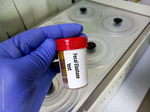 Stool sample with plastic container for Fecal Elastase test, to diagnosis pancreatic insufficiency. photo