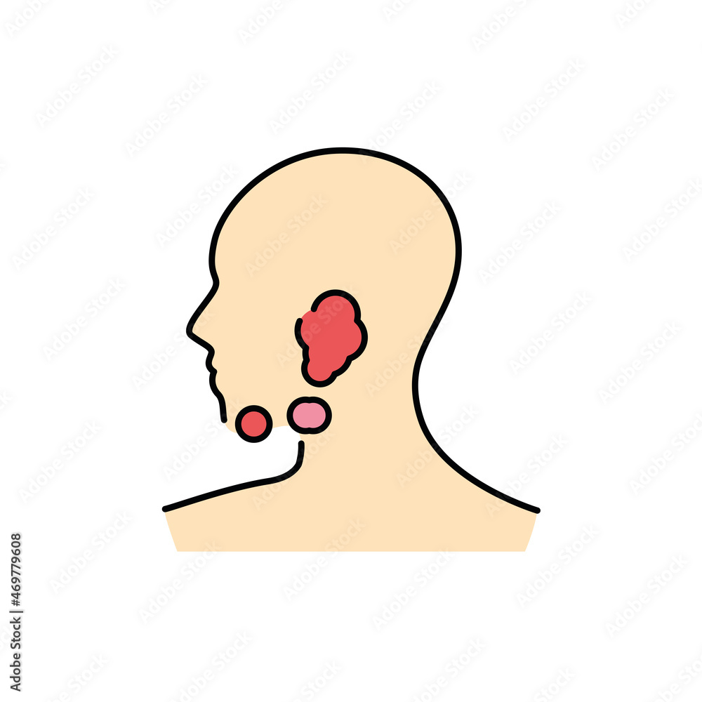 Inflammation of the submandibular lymph nodes color line icon. Human diseases. Inflammation of the submandibular lymph nodes color line icon. Human diseases.