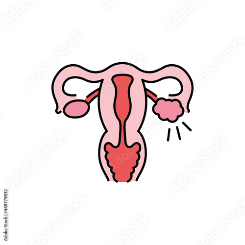 Polycystic ovary syndrome line color icon. Female reproductive system disease