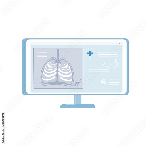 Cartoon flat x-ray photo of human chest on monitor screen isolated on empty background-health care,skeleton anatomy diagnostics,medical treatment,educational material concept,web site banner ad