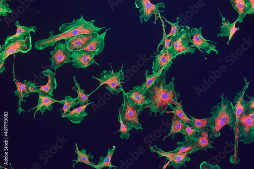 Fibroblast cells photo
