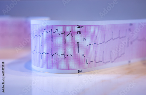 Close-up of a graph paper strip with black heart waves forming an electrocardiogram. photo