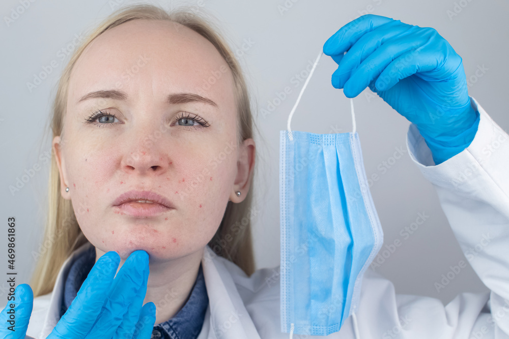 Doctor removes the protective mask and shows irritation on face skin. Antiviral measures. Means