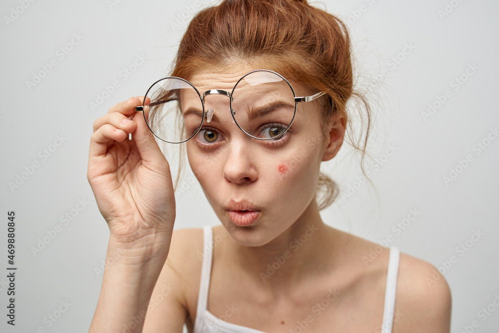 red-haired woman wearing glasses pimple on face dermatology skin care red-haired woman wearing glasses pimple on face dermatology skin care