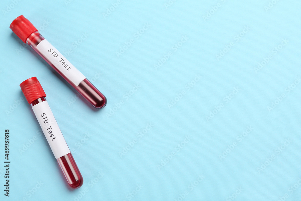 Tubes with blood samples and labels STD Test on light blue background, flat lay. Space for text Tubes with blood samples and labels STD Test on light blue background, flat lay. Space for text