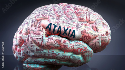 Ataxia in human brain, hundreds of crucial terms related to Ataxia projected onto a cortex to show broad extent of this condition  and to explore important concepts linked to Ataxia, 3d illustration photo