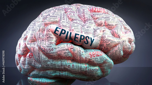 Canvas Print Epilepsy in human brain, hundreds of crucial terms related to Epilepsy projected