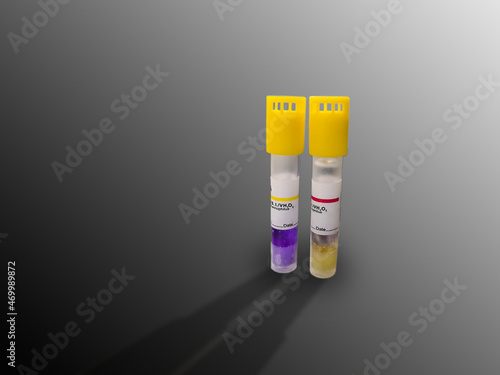 Two Positive And Negative Biological Indicators Of Hydrogen Peroxide Low Temperature Sterilization Machine. One Ampule Is Control And Other One Test. Selective Focus photo