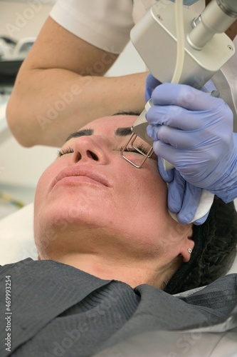 Laser pseudoblepharoplasty, removal of pigmentation, elimination of skin imperfections, in a beauty salon