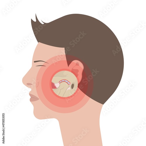 Temporomandibular Joint Disorders TMD TMJ treat pain displaced disc temporal bone locking bite plate plastic guard night Transcutaneous electrical nerve stimulation TENS Arthroscopy occlusal oral