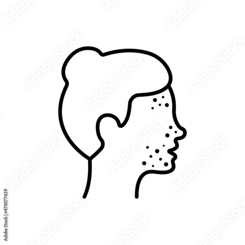Girl with Pimples on Face Line Icon. Woman with Blackhead, Acne, Rash Linear Pictogram. Dermatologic Problem, Allergy, Inflammation Skin Outline Icon. Editable Stroke. Isolated Vector Illustration