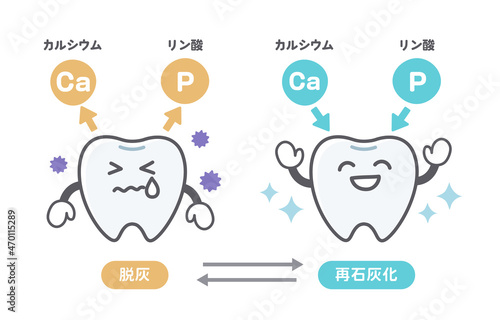脱灰と再石灰化に関する歯の可愛いイラスト