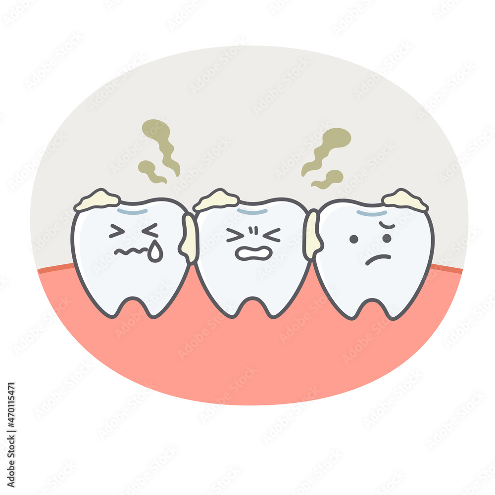 歯垢に悩む歯や歯茎のシンプルで可愛いイラスト Stock Vector Adobe Stock 歯垢に悩む歯や歯茎のシンプルで可愛いイラスト Stock Vector Adobe Stock
