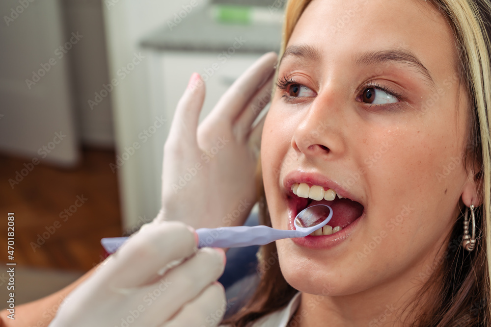 Dentist performing a visual examination with the speculum of the teeth of a young adolescent. Concept dental care, health care. Dentist performing a visual examination with the speculum of the teeth of a young adolescent. Concept dental care, health care.
