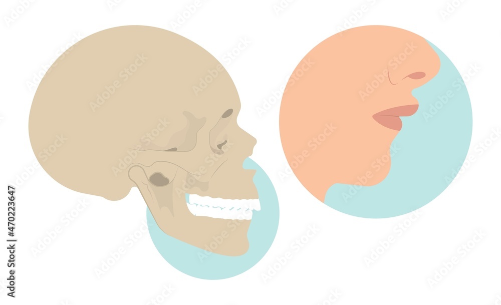 Jaw Surgery chin implant Sleep Apnea snoring upper airway plastic facial Cranio TMD TMJ joint Overbite teeth dental birth defects Open bite pain trauma cosmetic gummy smile bone reconstructive bad Jaw Surgery chin implant Sleep Apnea snoring upper airway plastic facial Cranio TMD TMJ joint Overbite teeth dental birth defects Open bite pain trauma cosmetic gummy smile bone reconstructive bad