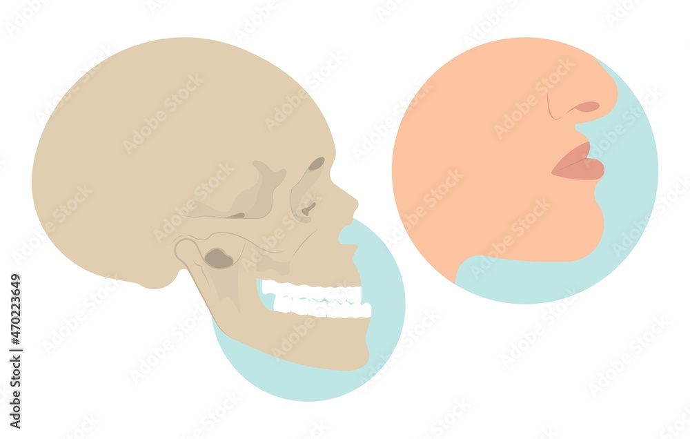 Jaw Surgery chin implant Sleep Apnea snoring upper airway plastic facial Cranio TMD TMJ joint Overbite teeth dental birth defects Open bite pain trauma cosmetic gummy smile bone reconstructive bad Jaw Surgery chin implant Sleep Apnea snoring upper airway plastic facial Cranio TMD TMJ joint Overbite teeth dental birth defects Open bite pain trauma cosmetic gummy smile bone reconstructive bad