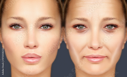 Aging. Mature woman-young woman.Face with skin problem.Showing photos before and after