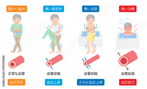 ヒートショック　シニアの男性　血管収縮と血管拡張　血圧上昇と血圧低下
