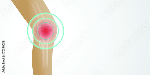 Knee painful. Joint pain. illustration medical concept on white background.