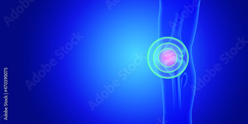 Knee painful. Blue human anatomy of knee. Skeleton x ray on blue background.