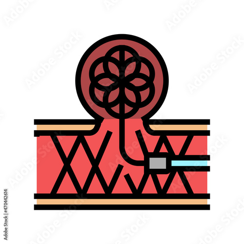 coil embolization color icon vector. coil embolization sign. isolated symbol illustration