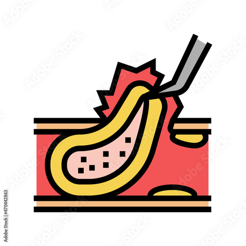 carotid endarterectomy color icon vector. carotid endarterectomy sign. isolated symbol illustration