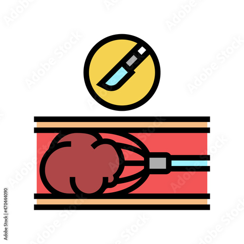 clot removal color icon vector. clot removal sign. isolated symbol illustration
