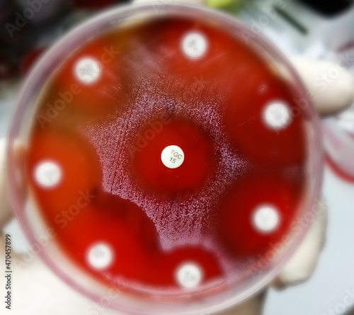 Antibiotic resistance testing. Selective focus show the inhibition zone of Tigecycline (TGC) antibiotic on microbial colony. tetracycline. photo